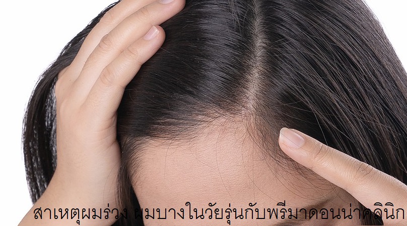 Tips to cover thinning hair