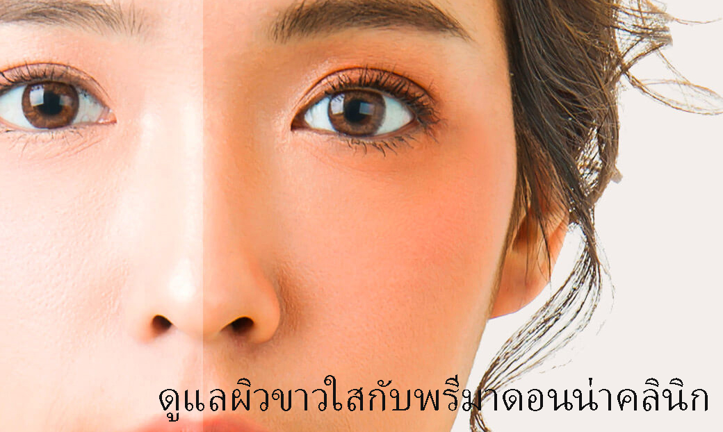 Skin Whitening in Chiangmai