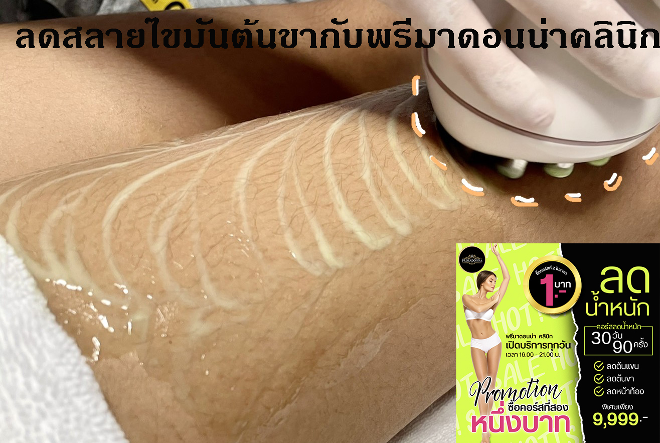 ลดสลายไขมันต้นขากับพรีมาดอนน่าคลินิก