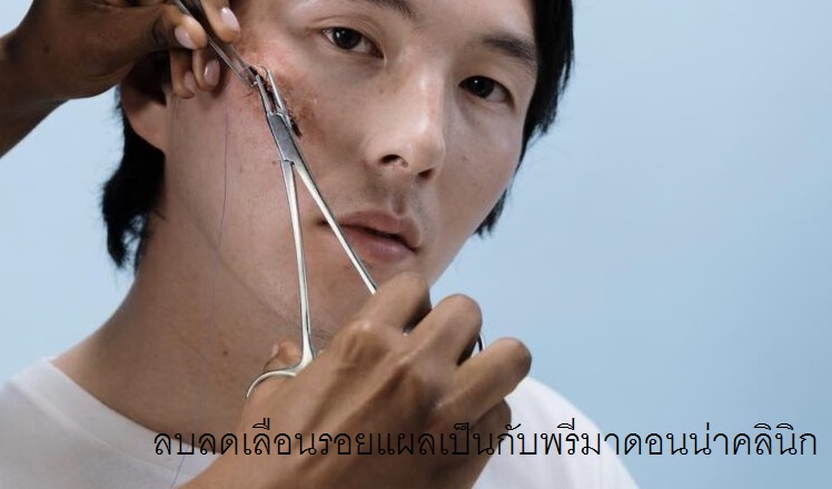 How to remove Scar in Chiangmai