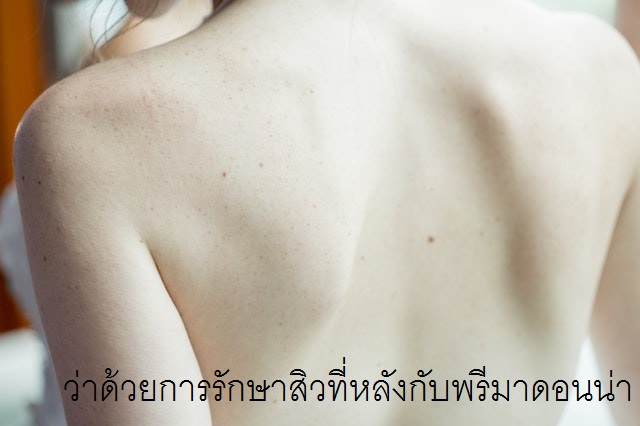 Back acne treatment in Chiangmai