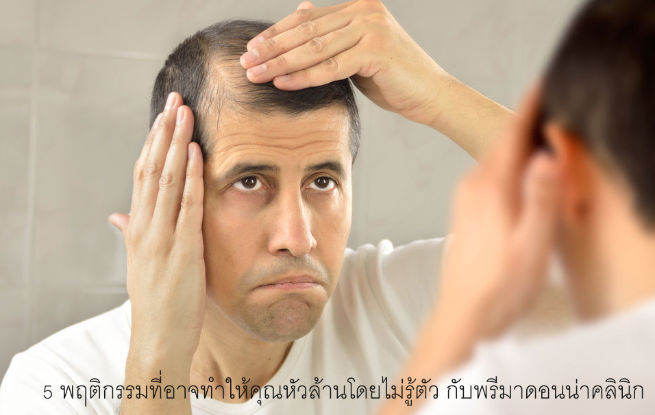 What Is Hair Loss (Baldness)?