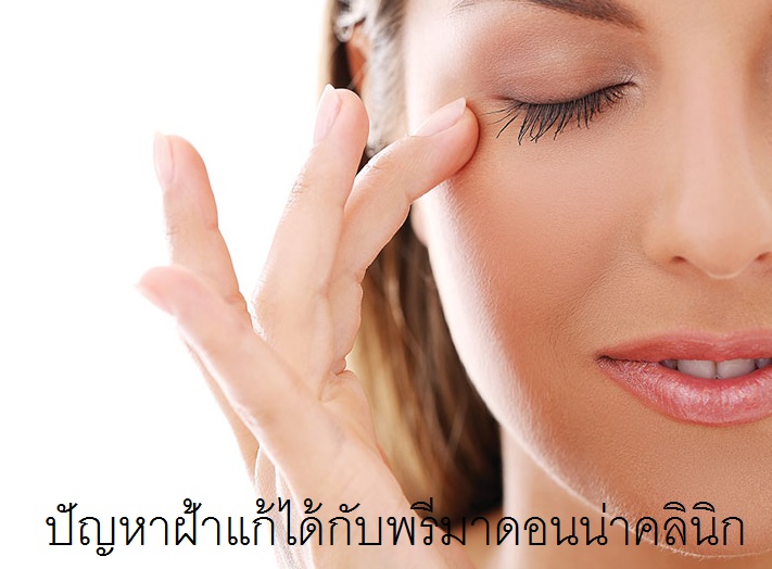 What’s Melasma in Chiangmai