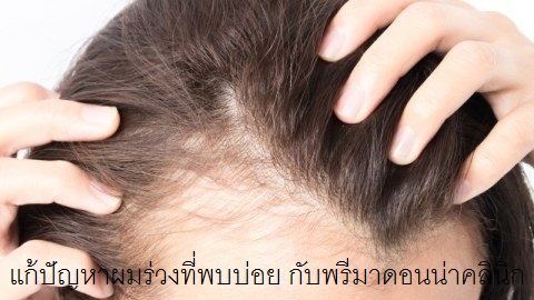12 Ways to Stop Hair Thinning
