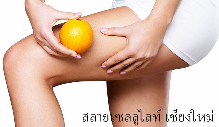 Cellulite Treatment in Chiangmai